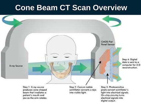 ct vs cbct|what is cone beam ct.